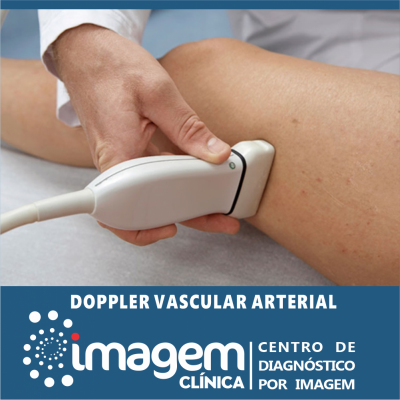 Doppler Vascular Arterial
