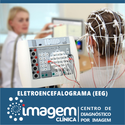 Eletroencefalograma (EEG)