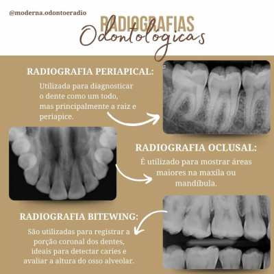 Odontologia e Radiologia Moderna
